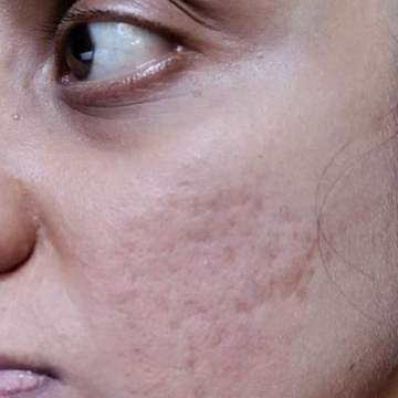 Before using Bio Retinol Elixir